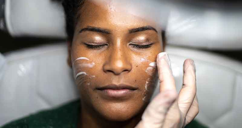 Chemical Peels
