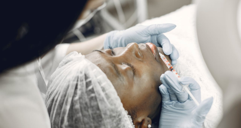 Vampire Facelift